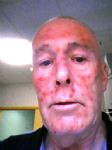 Salford tenant sprayed with acid